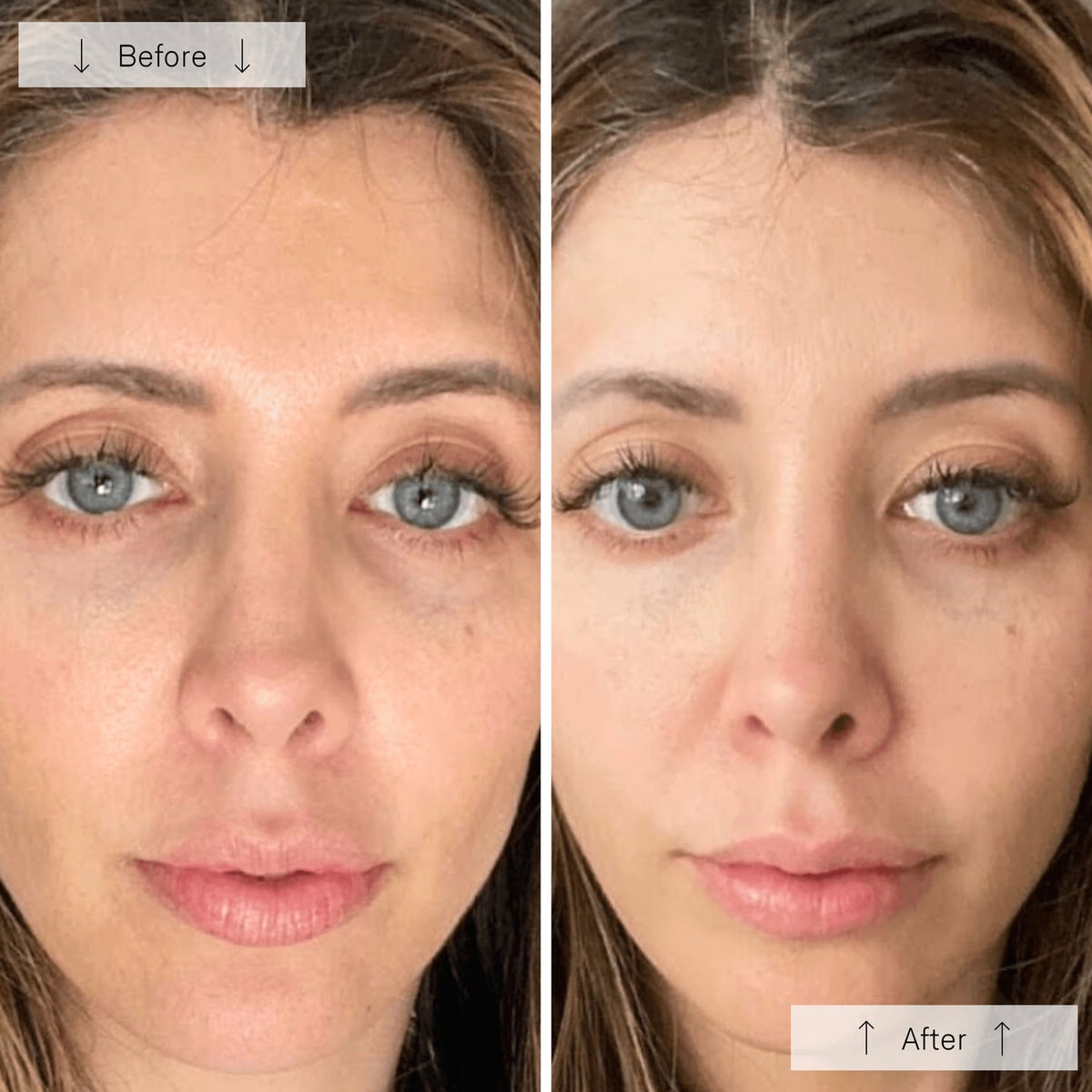 Before and After - Priya K. — Toronto, Canada