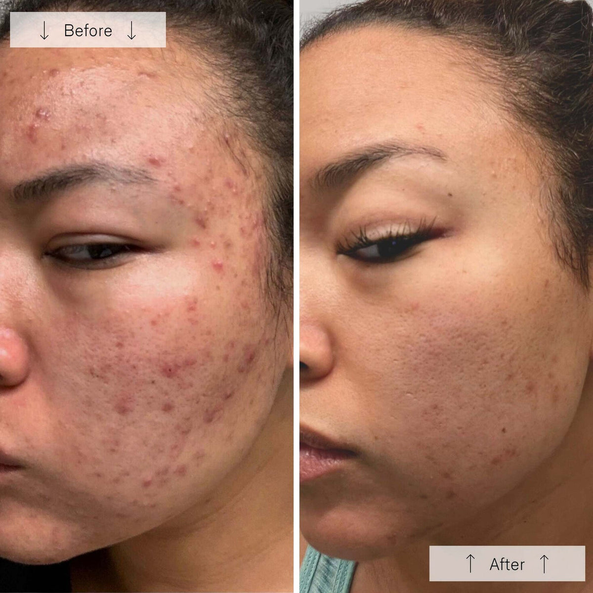 Before and After - Jessica L. — Sydney, Australia