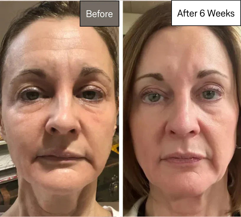 Before and After - Maria S. — Dubai, UAE